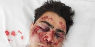 Grave Denuncia de Tortura en Antofagasta