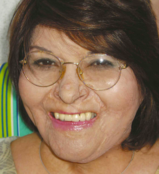 Carmen Gloria Quintana